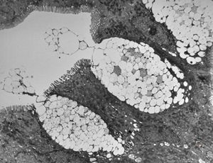 normal mucosa - duodenum - enterocytes and goblet cells